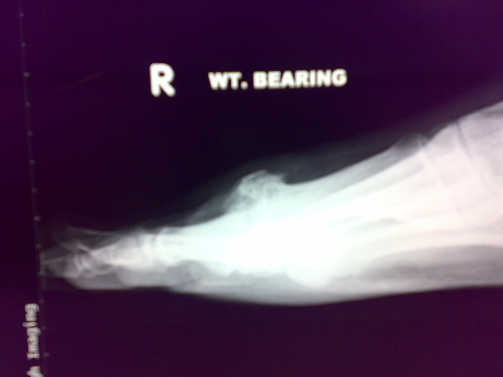 Image of arthritic joint